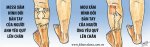 Biáº¿m há»a 22-03-2013-Caye-www.fcbarcelona.com.vn.jpg